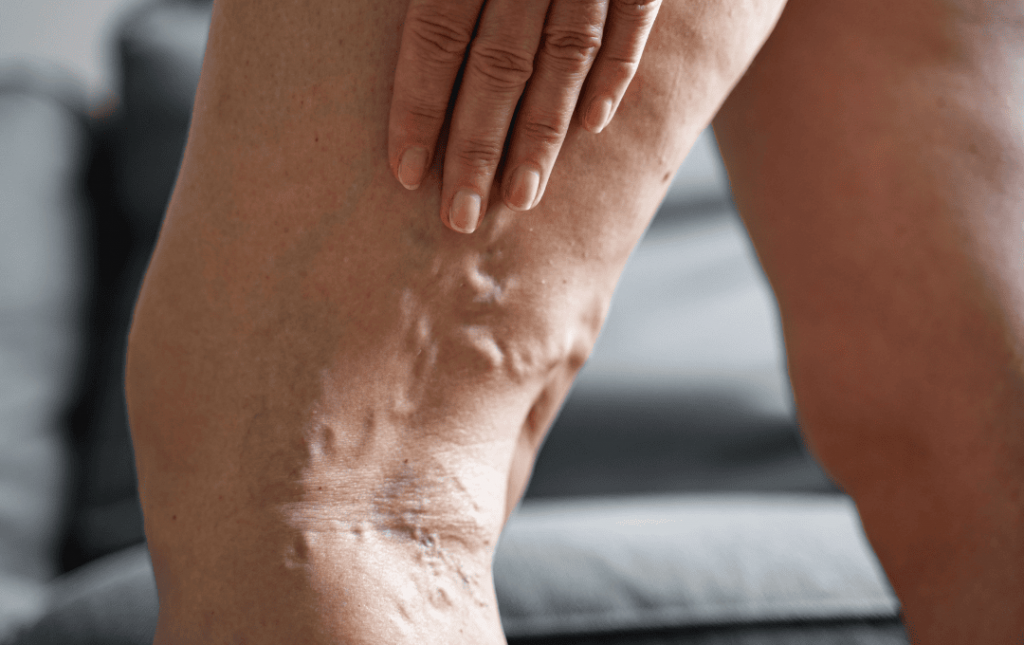 Why Does it Hurt To Stand?