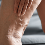 Why Does it Hurt To Stand?