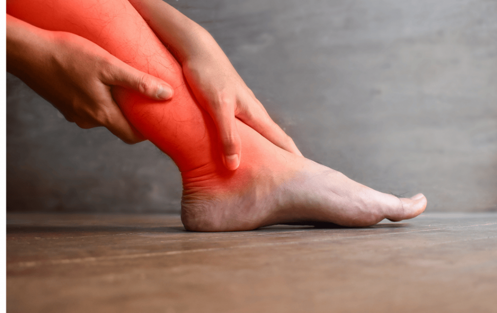 A Picture of a burning leg