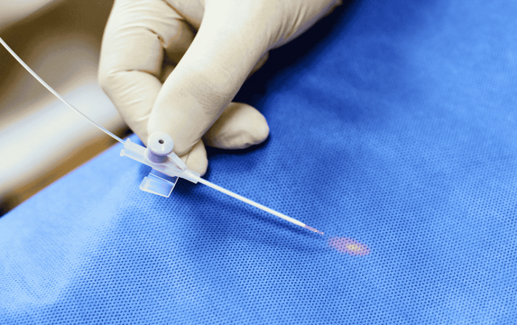 Laser vein Treatment