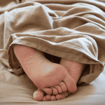 Varicose Veins Hurting while Sleeping