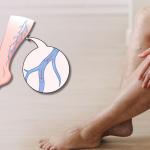 Looking at how to increase Blood Flow in Legs