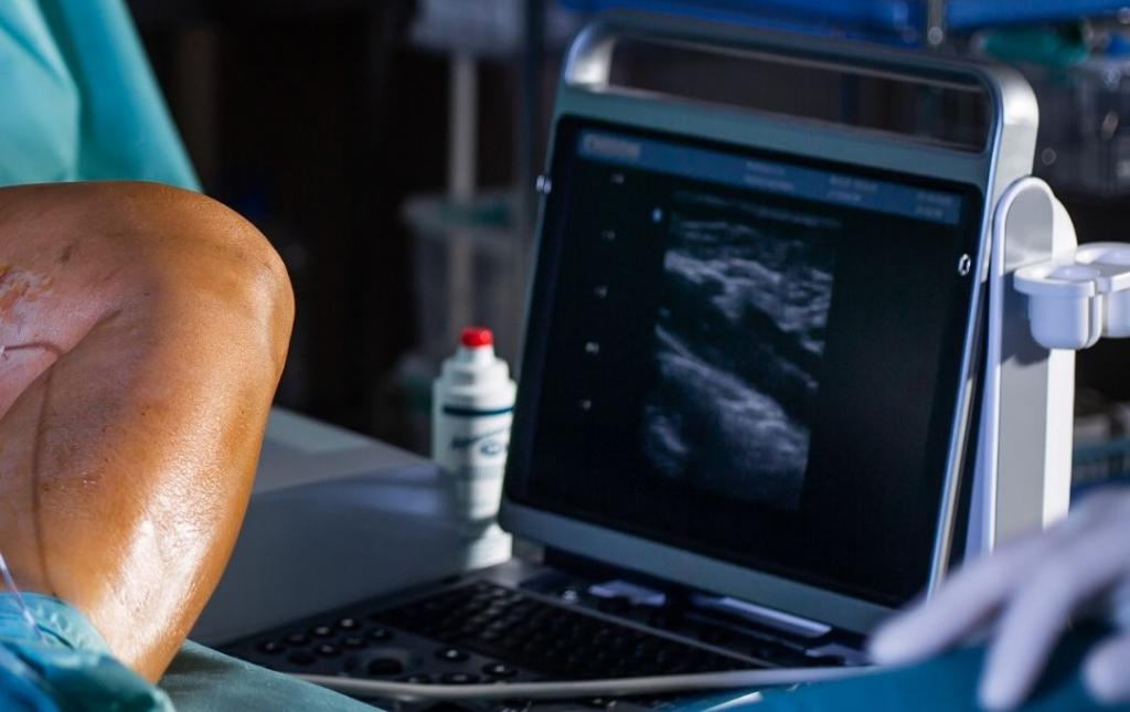Varicose Vein Treatment Options