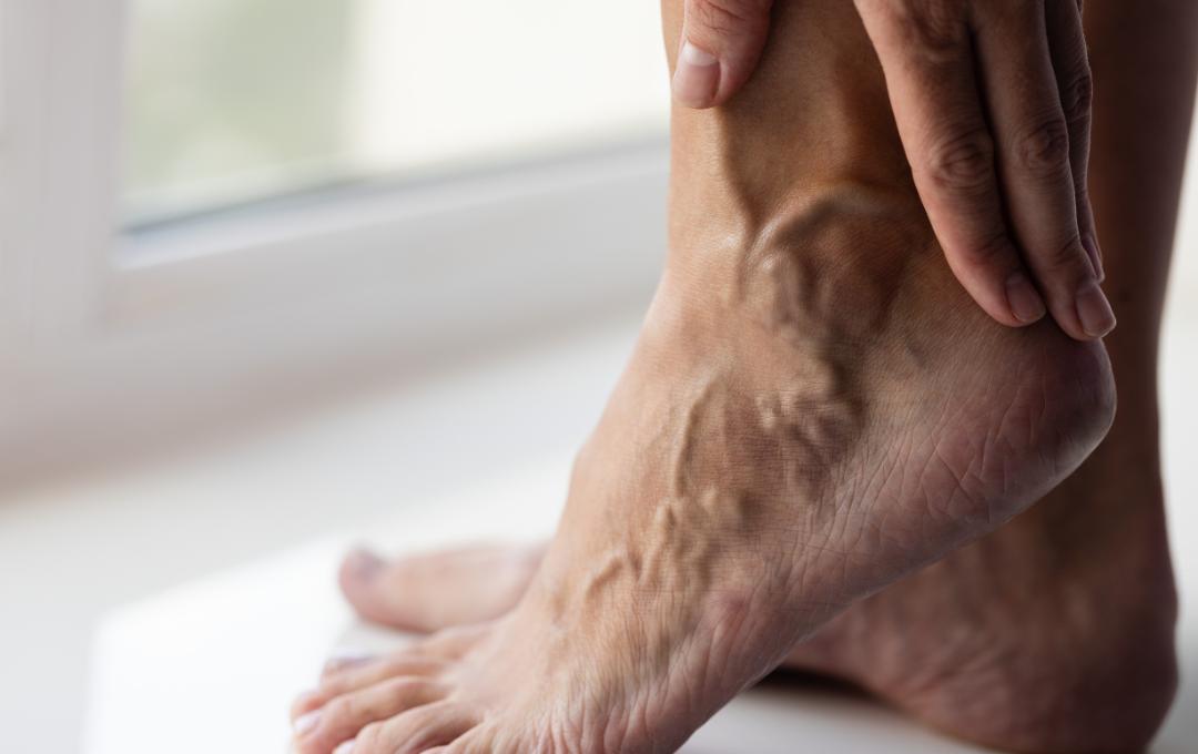 sudden bulging veins on feet