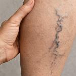 Look at Why The Blood In Your Legs is Dark