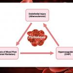 virchow’s triad