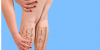 A photo of strong veins